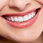 Approach to Cosmetic Dentistry